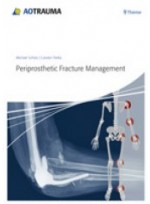 Periprosthetic Fracture Management