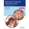 Endoscopic Sinonasal Dissection Guide: Including Orbit and Skull Base ,2e