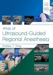 Atlas of Ultrasound-Guided Regional Anesthesia, 3/e 