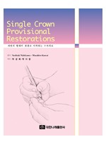 Single Crown Provisional Restorations  