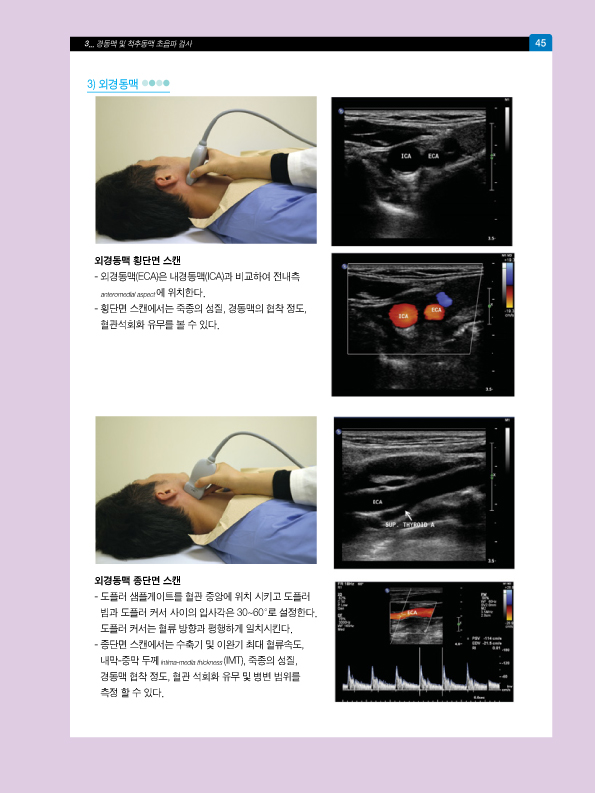 동영상으로 쉽게 배우는 혈관초음파   