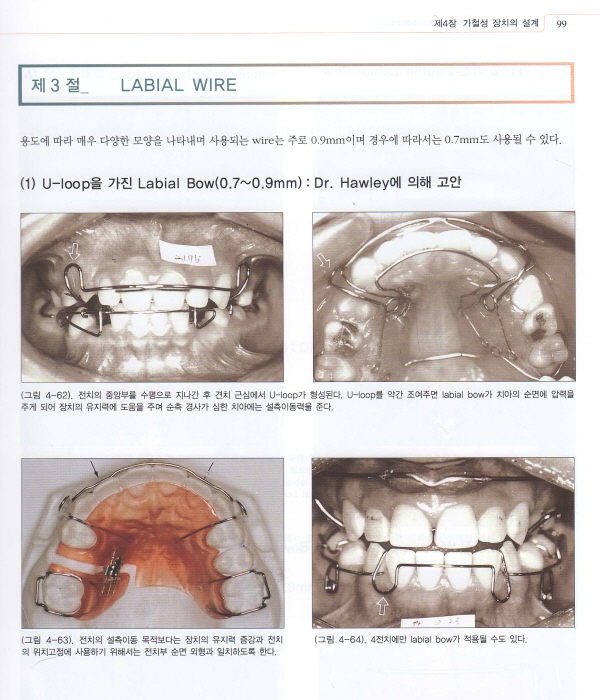 임상치과교정학 Color Atlas  3판 