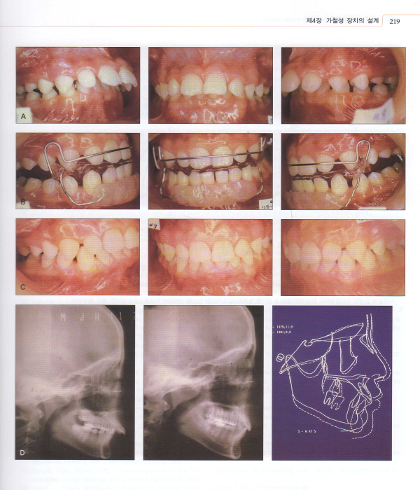 임상치과교정학 Color Atlas  3판 