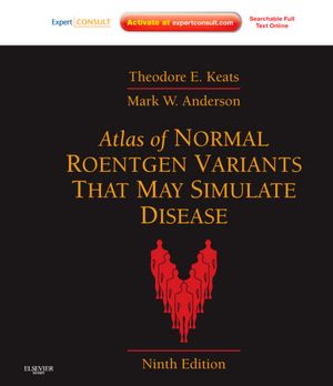 Atlas of Normal Roentgen Variants That May Simulate Disease, 9/e 