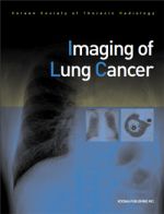 Imaging of Lung Cancer(군자)