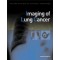 Imaging of Lung Cancer(군자)