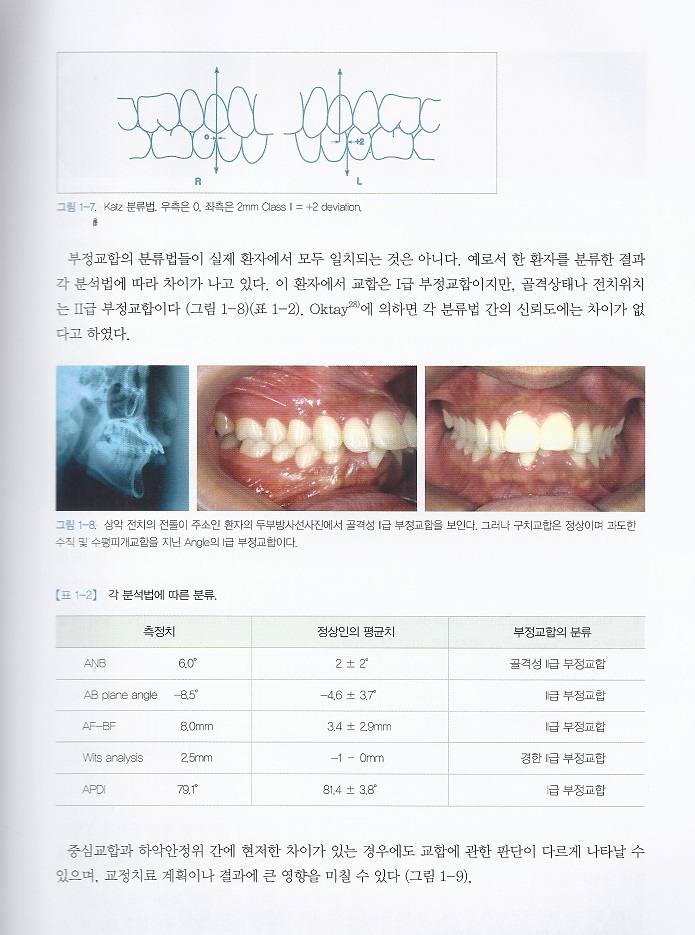 개원의를 위한 가이드 북 - 교정 치료과정에서 선택의 기준 