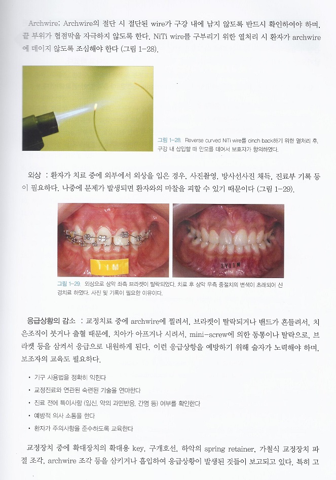 개원의를 위한 가이드 북 - 교정 치료과정에서 선택의 기준 