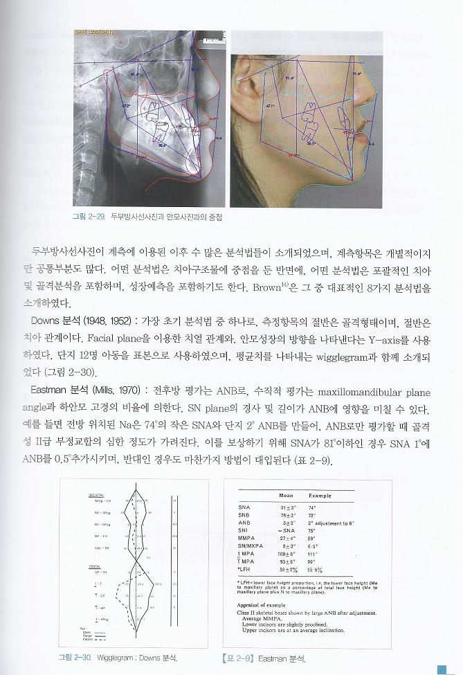 개원의를 위한 가이드 북 - 교정 치료과정에서 선택의 기준 