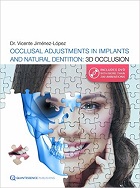 Occlusal Adjustments in Implants and Natural Dentition: 3D Occlusion 1st Edition 