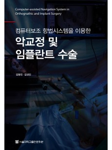 컴퓨터보조 항법시스템을 이용한 악교정 및 임플란트 수술 