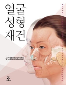 얼굴성형재건