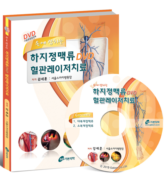 손에 잡히는 하지정맥류DVD 혈관레이저치료   