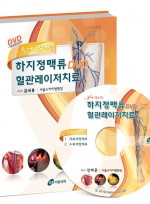 손에 잡히는 하지정맥류DVD 혈관레이저치료   