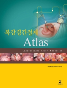 복강경 간절제 Atlas