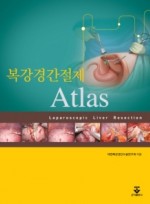 복강경 간절제 Atlas