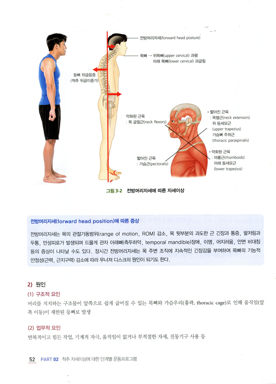 자세교정을 위한 단계별 운동처방