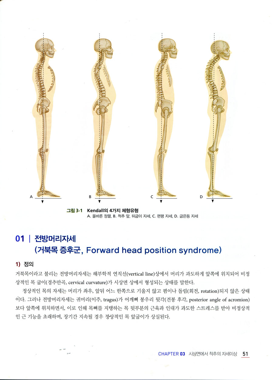 자세교정을 위한 단계별 운동처방