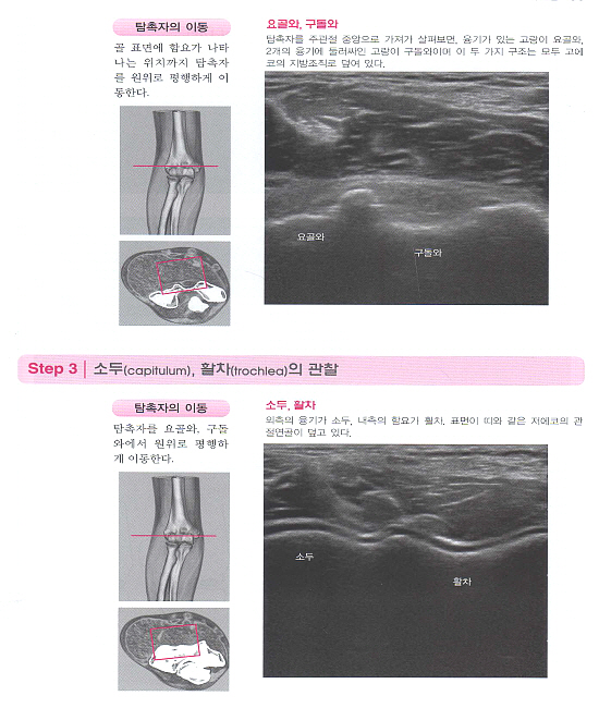 단계별로 배우는 근골격계 초음파: 해부 진단 테크닉 [양장본] 