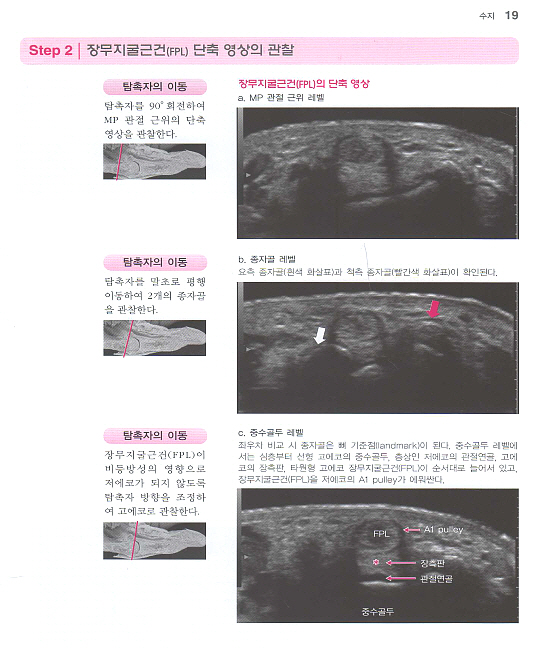 단계별로 배우는 근골격계 초음파: 해부 진단 테크닉 [양장본] 