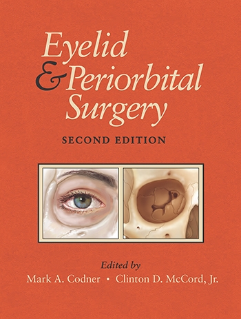 Eyelid and Periorbital Surgery, Second Edition (2vols)