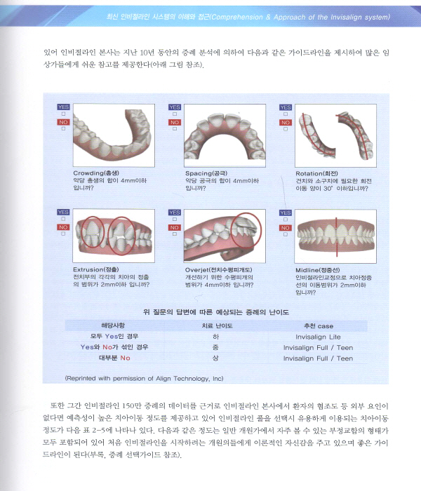 최신 인비절라인 시스템의 이해와 접근