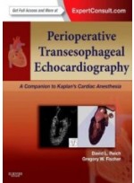 Perioperative Transesophageal Echocardiography