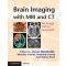 Brain Imaging with MRI and CT: An Image Pattern Approach 