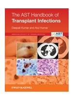 The AST Handbook of Transplant Infections