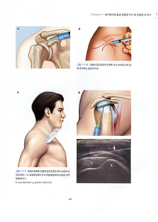 근골격계 신경차단술과 주사요법