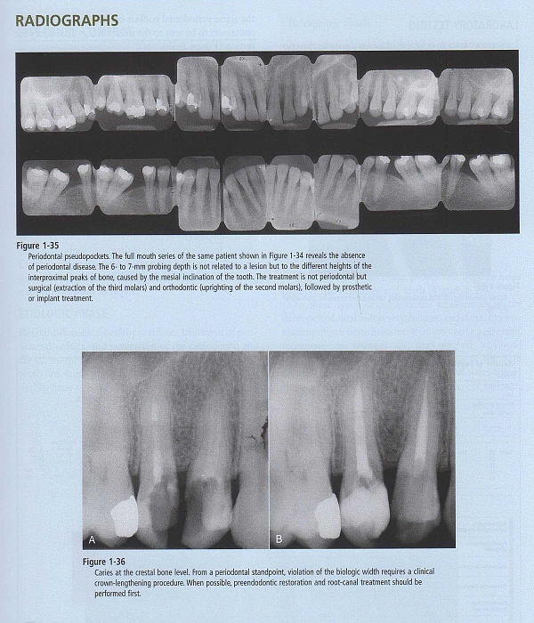 Restorative Dentistry  