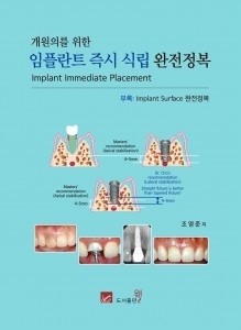 개원의를 위한 임플란트 즉시 식립 완전정복