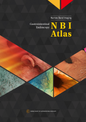 Gastrointestinal endoscopy - NBI Atlas