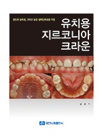 유치용 지르코니아 크라운 