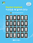 (Implant 임상지침서) Dental Implant 이것만은 꼭 알아야 한다! 