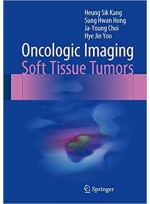 Oncologic Imaging: Soft Tissue Tumors