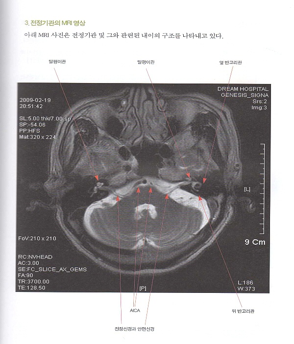 어지럼과 이명 그림으로 보다