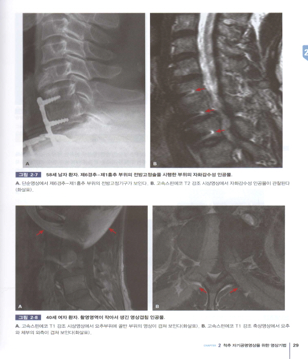 척추영상진단 Spinal Imaging