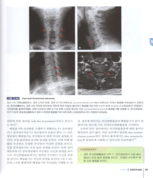 척추영상진단 Spinal Imaging