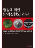 영상에 의한 망막질환의 진단(IMAGE BASED DIAGNOSIS OF RETINAL DISEASE)