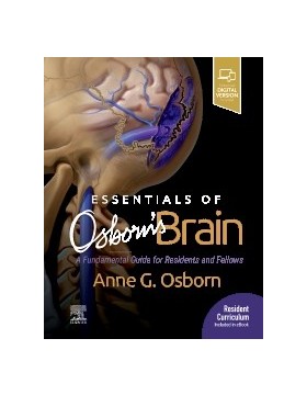 Essentials of Osborn's Brain