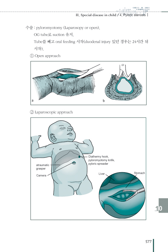 서울아산병원 외과 매뉴얼(AMC Manual of Surgery),2판