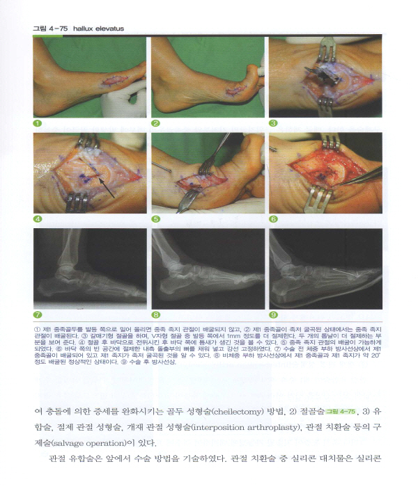 족부 족관절학 : (책+동영상CD:2)  