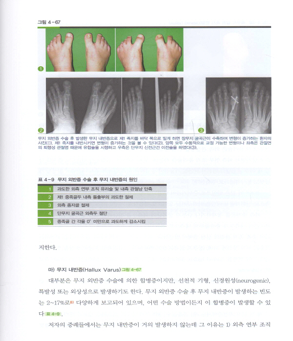 족부 족관절학 : (책+동영상CD:2)  