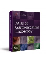 Atlas of Gastrointestinal Endoscopy - Upper gastrointestinal endoscopy, Colonoscopy