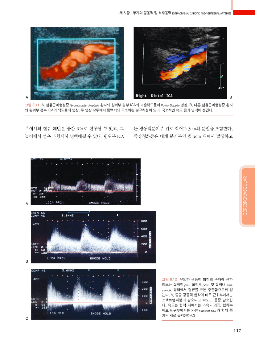 혈관초음파 - 혈관질환에서의 듀플렉스 스캐닝, 4/e 