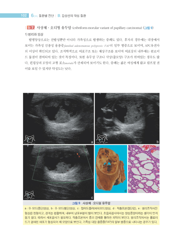 갑상선초음파진단 Guidebook,2판