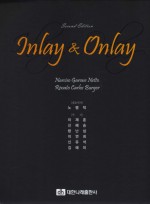  Inlay & Onlay 2nd Edition  