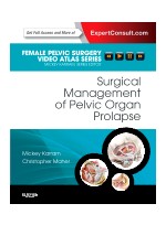 Surgical Management of Pelvic Organ Prolapse 