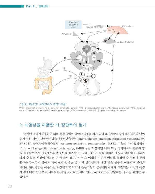 과민성장증후군